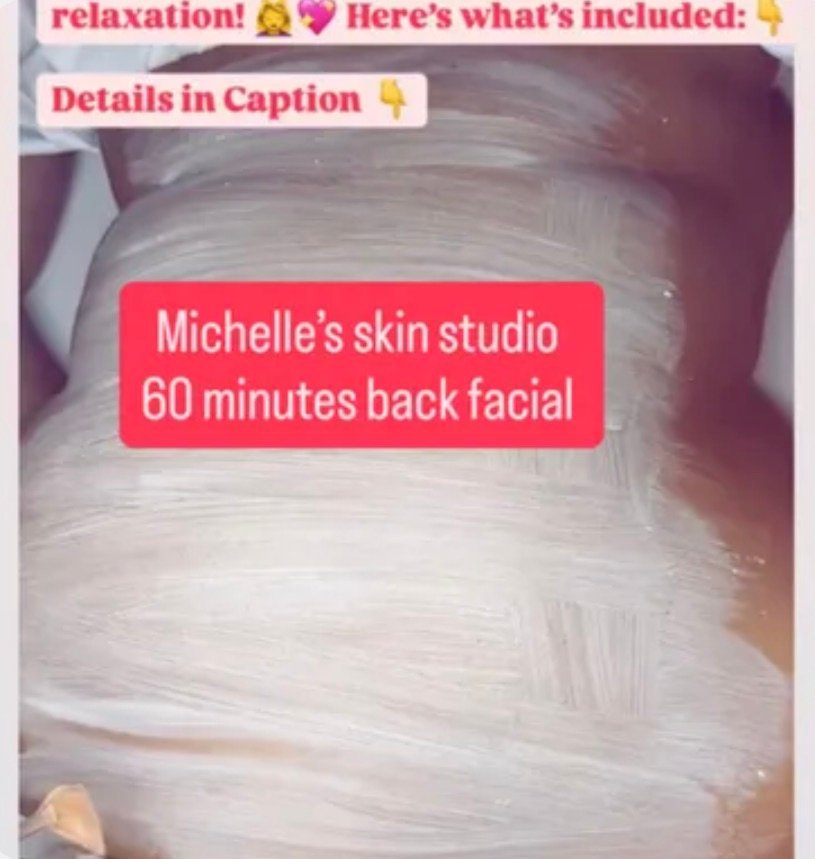 Back Facial at Michelle's Skin Studio